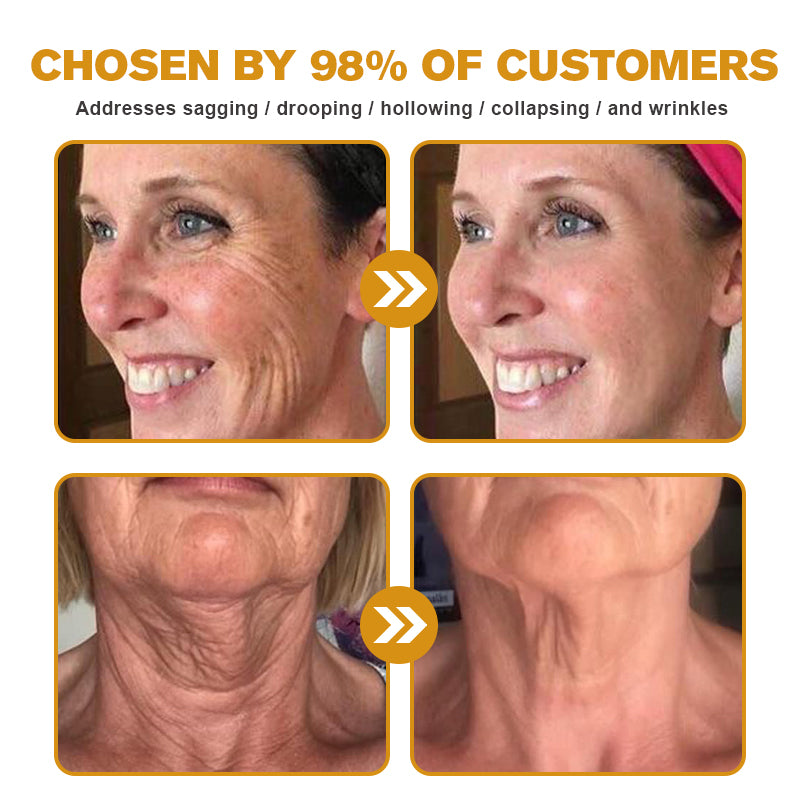 🎁Seurico™ Botox Bee Venom Wrinkle Removal Cream✨🐝