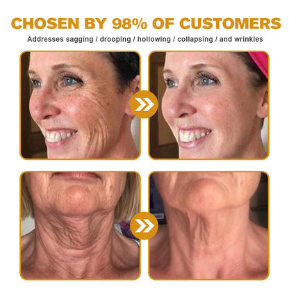 🎁Seurico™ Botox Bee Venom Wrinkle Removal Cream✨🐝
