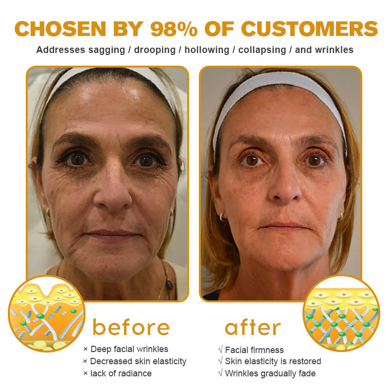 🎁Seurico™ Botox Bee Venom Wrinkle Removal Cream✨🐝