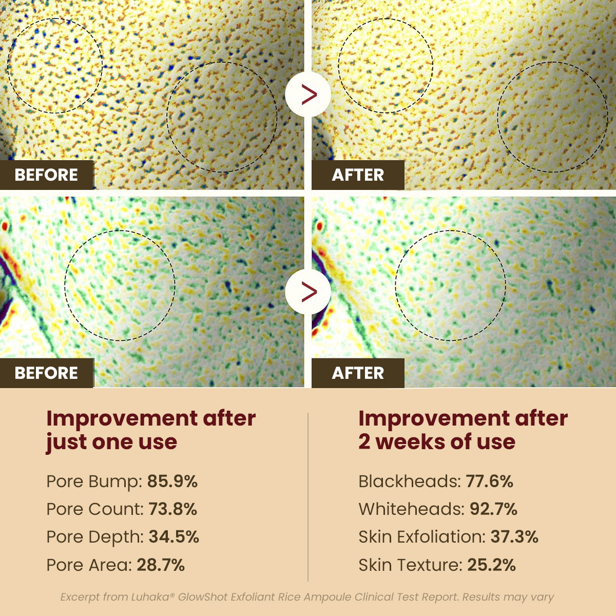 ODEIUN™ GlowRice Brightening Ampoule|Reveal Radiant Skin with Every Drop — Powered by Rice Essence ✨🌾