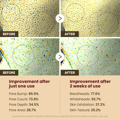 ODEIUN™ GlowRice Brightening Ampoule|Reveal Radiant Skin with Every Drop — Powered by Rice Essence ✨🌾